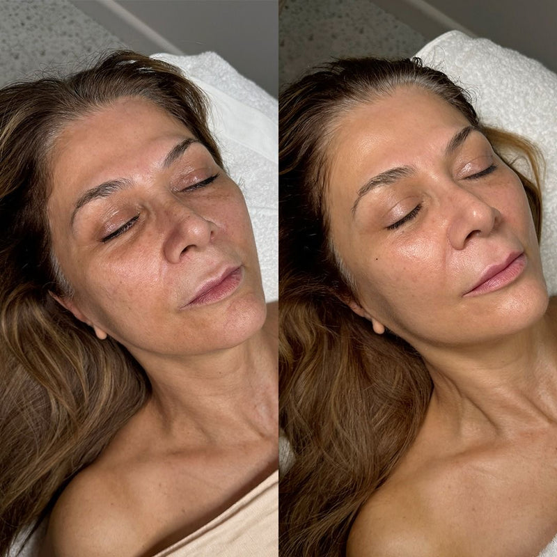 Ines Viklund – visible results after 35 days