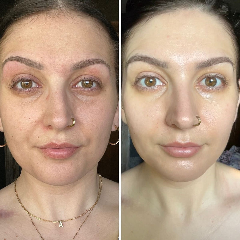 Saga Holmgren – hydrated and fresh complexion withing 4 weeks