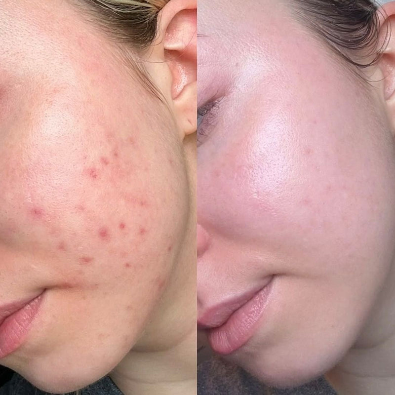 Maja Eriksson – visible results after 21 days
