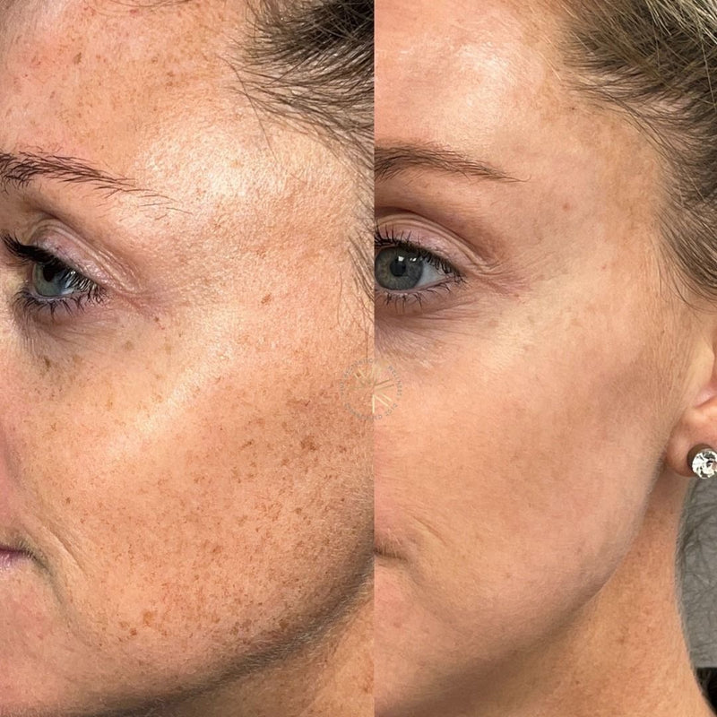 Evelien Smits – een stralendere en gladdere teint na 28 dagen